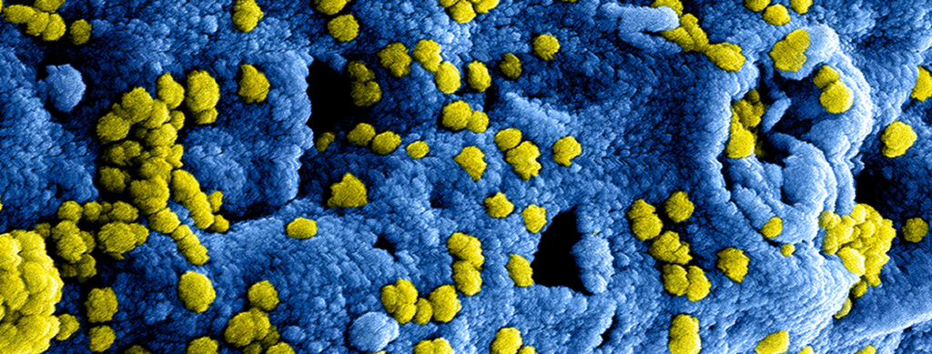 coronavirus e-commerce